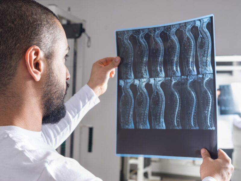 photo of a doctor viewing an x-ray image of an injured patient's spine 